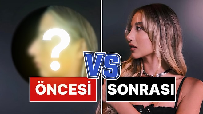 Doktoru, Aleyna Kalaycıoğlu'nun Burun Ameliyatından Önceki ve Sonraki Halini Paylaştı!