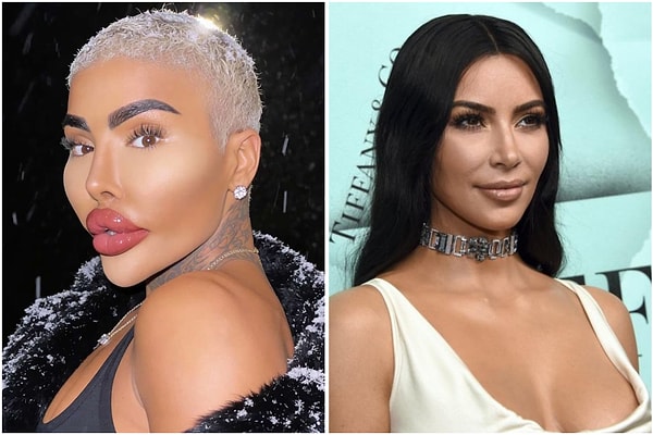 Jordan James Parke uzun süredir geçirdiği estetik işlemlerle adını duyurmuştu.