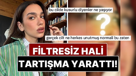 Dua Lipa'nın Cildinin Filtresiz Hali Sosyal Medyada Tartışma Yarattı!