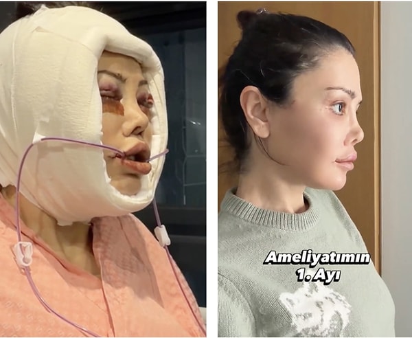 Didem Ceran son paylaşımında yaşadığı sağlık sorunundan bahsederek göğüs kanseriyle mücadele ettiğini açıkladı.