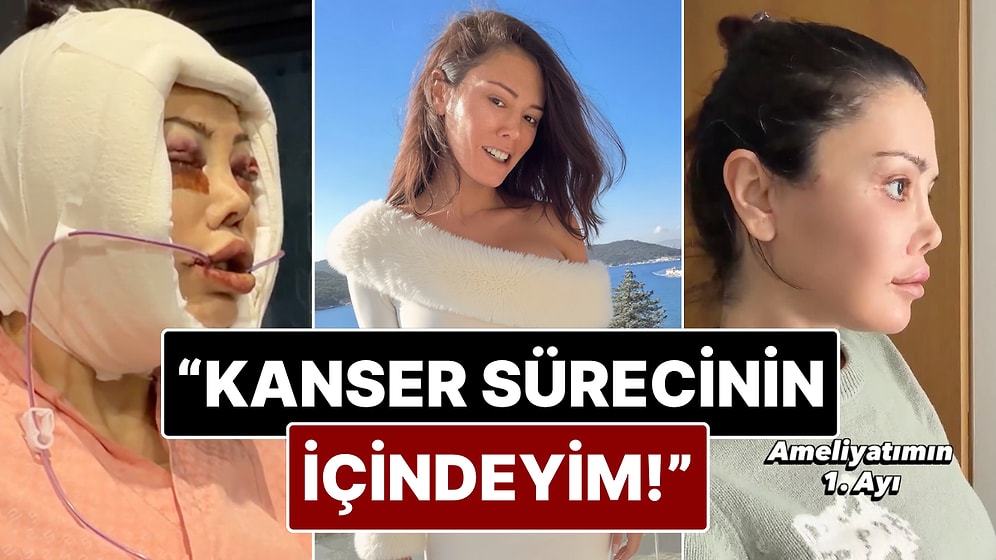 Yaptırdığı Estetiklerle Dikkat Çeken Didem Ceran Kansere Yakalandığını Açıkladı!
