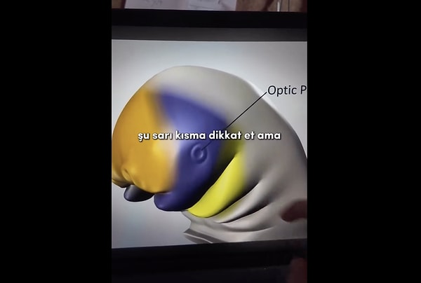 Yani "popo çene" veya tıbbi adıyla yarık çene (cleft chin) oluşumunun sebebi tamamen anne karnındaki gelişim süreciyle ilgili. Yani bu durum bir hastalık değil, sadece anatomik bir çeşitlilik.