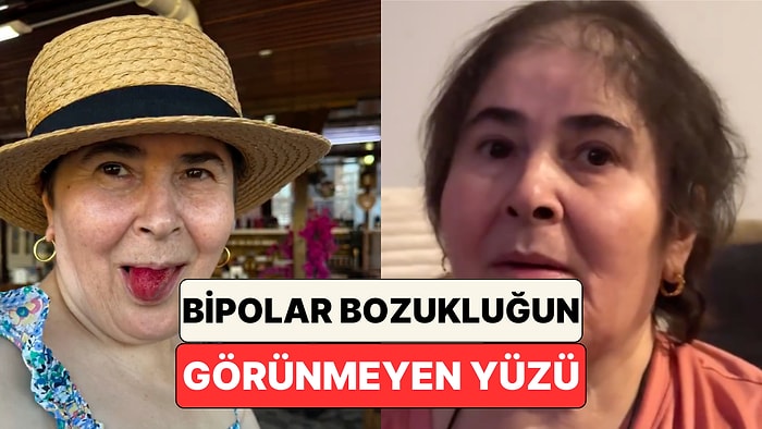 Bir Kadın Bipolar Bozukluğu Olan Annesinin Atak Geçirdiği Dönemler ile Normal Halini Karşılaştırdı