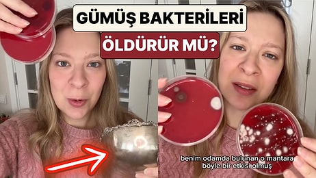 Genetik Mühendisi Dilara Sarı Gümüşün Antimikrobiyal Özelliğini Bir Deney ile Gösterdi