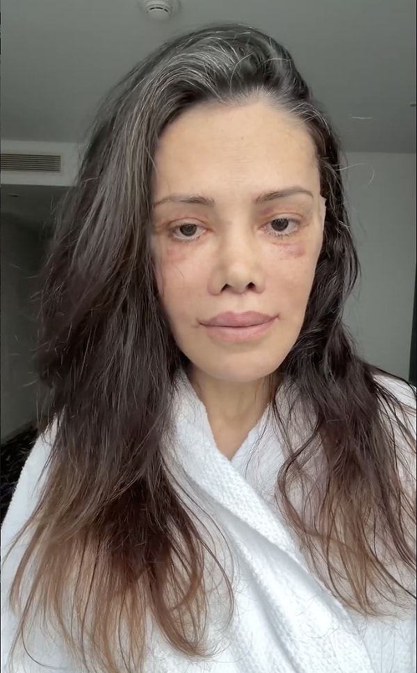 Survivor yarışmasından bu yana adını sık sık magazin manşetlerinde gördüğümüz Didem Ceran, açıklamaları ve radikal kararlarıyla gündem olmayı başarıyor.