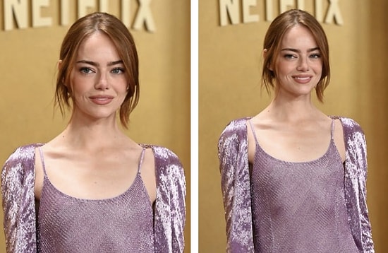 Emma Stone’s Latest Look Sparks Confusion Among Fans