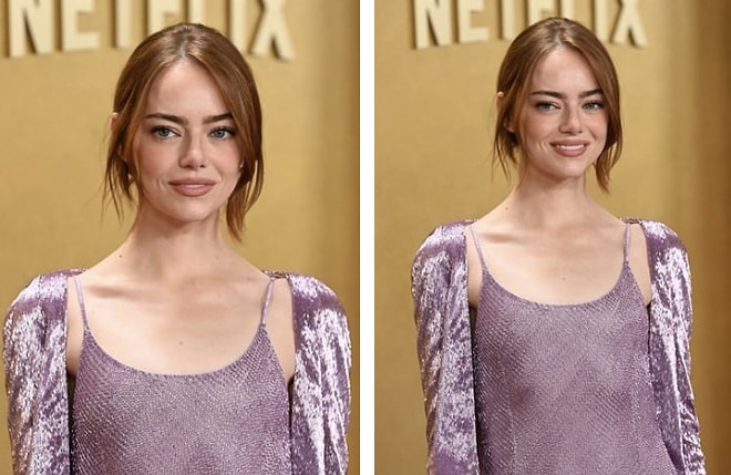 Emma Stone’s Latest Look Sparks Confusion Among Fans