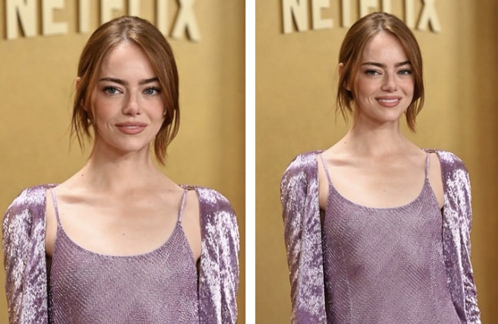 Emma Stone’s Latest Look Sparks Confusion Among Fans