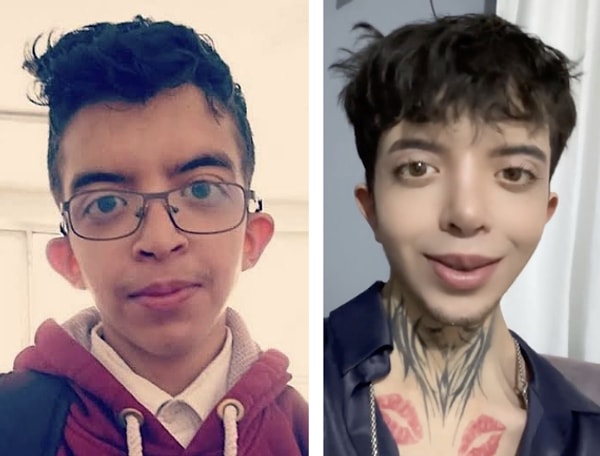 Kulak, burun ve göz kapağı ameliyatı geçirdiğini açıklayan fenomen, yüzündeki değişimle dikkat çekti.