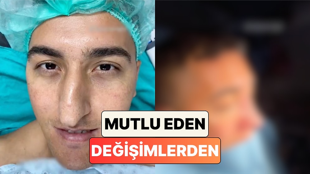 Mutlu Eden Değişimlerden: Bir Doktor Burun Estetiği Yaptığı Hastasının Değişimini Paylaştı