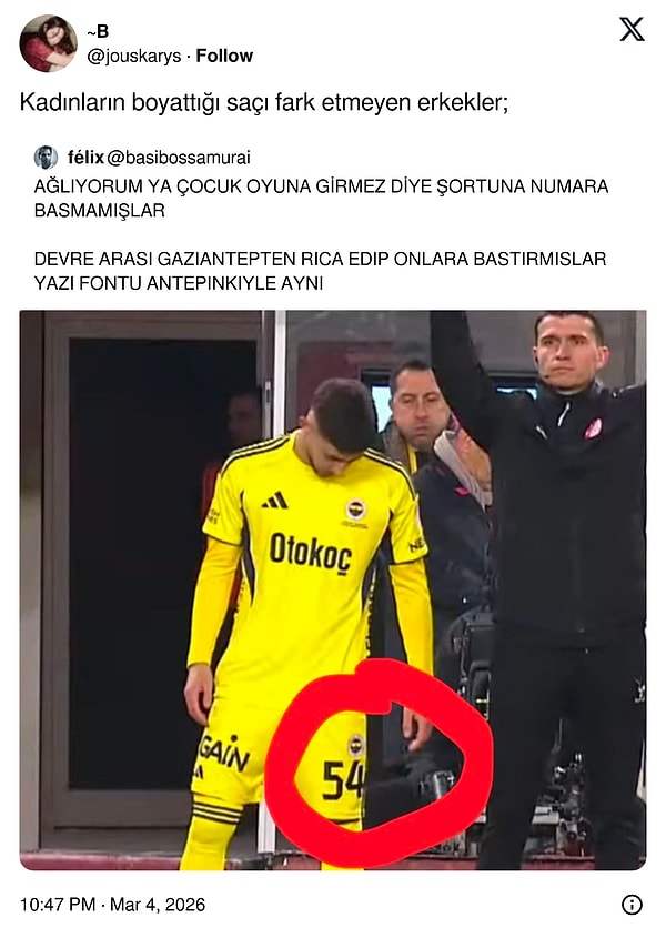 Detaycılık ayrı bir olay...