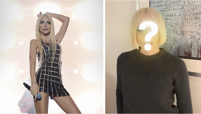 Singer Gülşen’s Facial Transformation Sparks Attention on Social Media