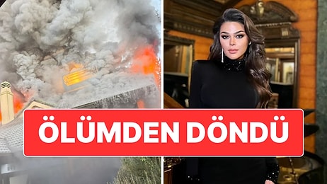 Oyuncu Aslıhan Karalar Evinde Çıkan Yangın Nedeniyle Ölümden Döndü