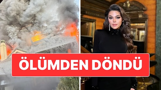 Oyuncu Aslıhan Karalar Evinde Çıkan Yangın Nedeniyle Ölümden Döndü