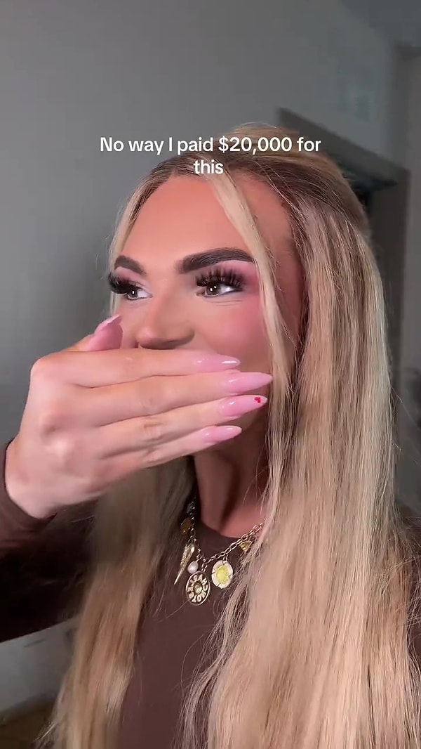 ABD’de yaşayan 25 yaşındaki Bay Stone, daha büyük ve daha beyaz bir gülüşe sahip olmak için diş kaplamalarını yeniletti.