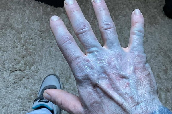 Sabah uyandığında kendini "Avatar" gibi görünce soluğu hastanede aldı