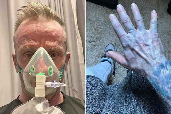 Hastanede oksijen verildi, doktorlar ciddi hastalık ihtimalini araştırmaya başladı