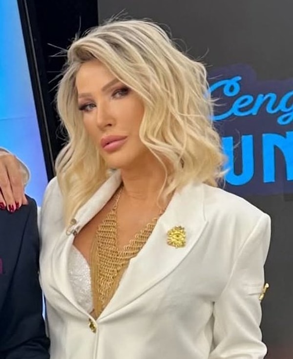 Seda Sayan’ın yıllardır konuşulan bir diğer konusu ise geçirdiği estetik operasyonlar ve güzellik uygulamaları.