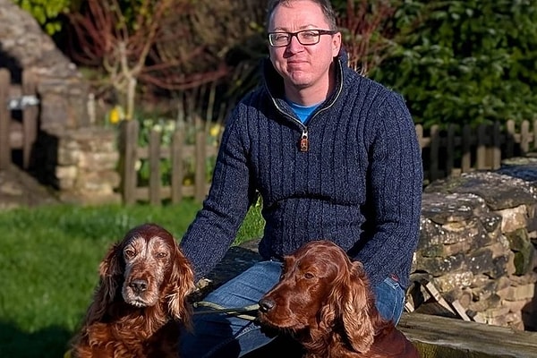 Galler’in Monmouth kentinde yaşayan 38 yaşındaki mimar Craig Alexander, yıllar boyunca baş ağrısı ve baş dönmesi yaşamasına rağmen bu belirtileri yoğun çalışma temposuna, yorgunluğa ve susuzluğa bağladı.