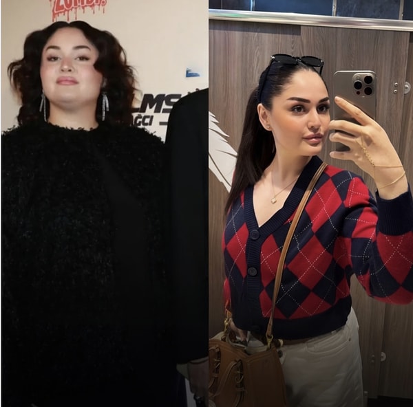 Naz Şenlendirici bu kez sesiyle değil, yaşadığı değişimle gündeme geldi.