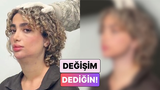 Değişim Dediğin: Gıdı Operasyonu Geçiren Bir Kadın Yaşadığı Değişimi Paylaştı
