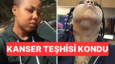 Yıllarca Cilt Hastalığı Sandı: Gerçek Yıllar Sonra Ortaya Çıktı, 4. Evre Kanser Teşhisi Kondu
