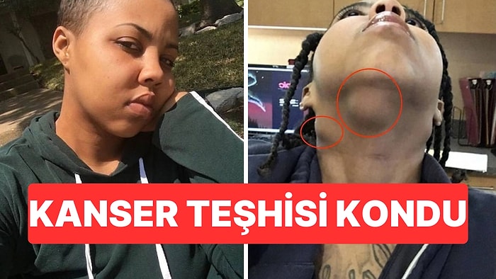 Yıllarca Cilt Hastalığı Sandı: Gerçek Yıllar Sonra Ortaya Çıktı, 4. Evre Kanser Teşhisi Kondu
