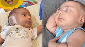 Newborn Ear Surgery Controversy: Mother’s Decision to Fix Infant’s Ears Sparks Heated Social Media Debate