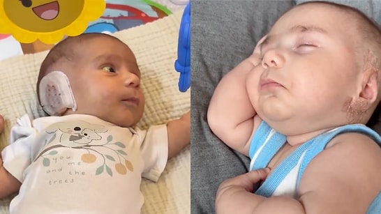 Newborn Ear Surgery Controversy: Mother’s Decision to Fix Infant’s Ears Sparks Heated Social Media Debate