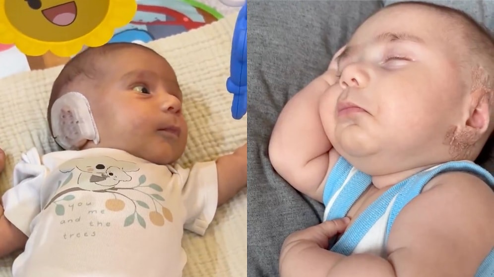 Newborn Ear Surgery Controversy: Mother’s Decision to Fix Infant’s Ears Sparks Heated Social Media Debate