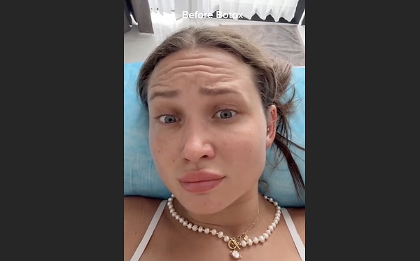 Eskiden botoks işlemi çok ileri yaşlarında insanların yaptırdığı bir işlem olarak bilinse de günümüzde, kırışıklıklar yerleşmeden yapılmaya başlanıyor. Bu yüzden botoks yaşı oldukça düştü.