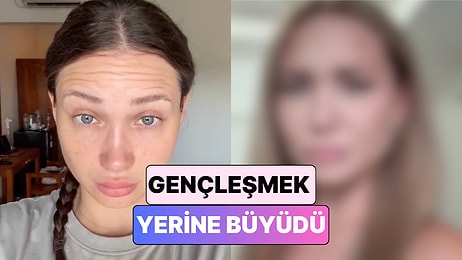 Gerekli mi Erken mi? Botoks Yaptıran 25 Yaşındaki Kadın Yaşadığı Değişimi Paylaştı