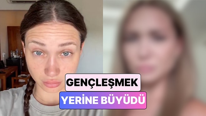 Gerekli mi Erken mi? Botoks Yaptıran 25 Yaşındaki Kadın Yaşadığı Değişimi Paylaştı