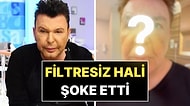 Yüzü Dolgudan Geçilmeyen Kuşum Aydın Filtresiz Son Halini Paylaştı!