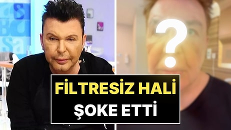 Yüzü Dolgudan Geçilmeyen Kuşum Aydın Filtresiz Son Halini Paylaştı!