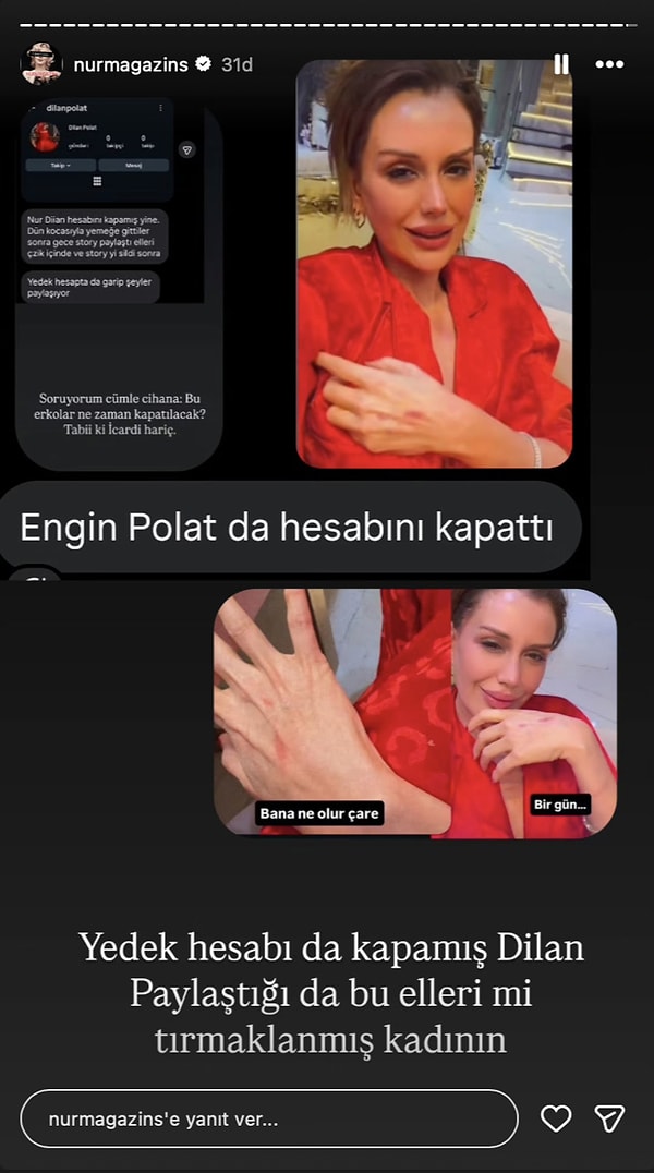 Eskiye nazaran daha az olsa da sosyal medya paylaşımlarıyla hala sık sık gündem olan Dilan Polat'ın gece yaptığı paylaşımlar tüm gözlerin üzerine çevrilmesine sebep oldu.