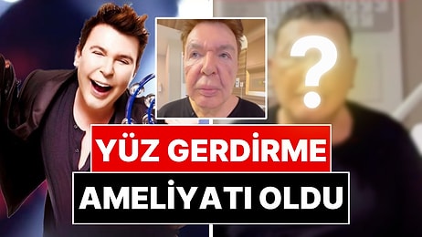 Yüz Gerdirme Ameliyatı Olan Kuşum Aydın'ın Son Hali Ortaya Çıktı!