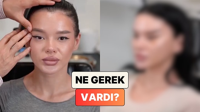Badem Göz Estetiği Yaptıran Bir Kadının Değişimi "Ne Gerek Vardı?" Dedirtti