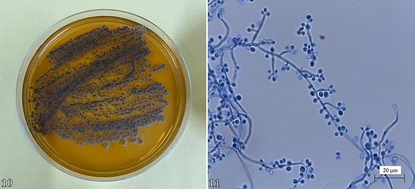 Mantarın bulaşmasında kedilerin rolü büyük.