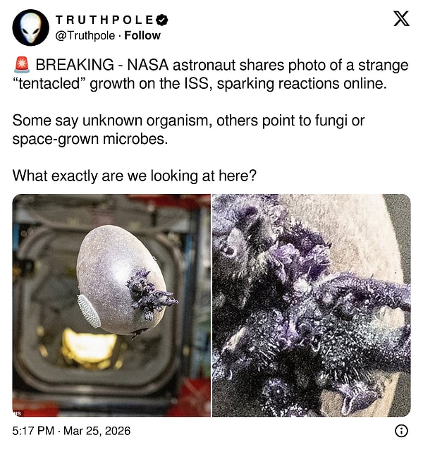 "Bilinmeyen bir organizma, mantar, mikrop..."