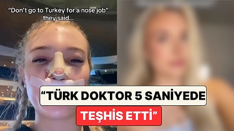 Burun Estetiği İçin "Türkiye’ye Gitme" Diyenleri Dinlemeyen Kadın Yaşadığı Değişimi Paylaştı