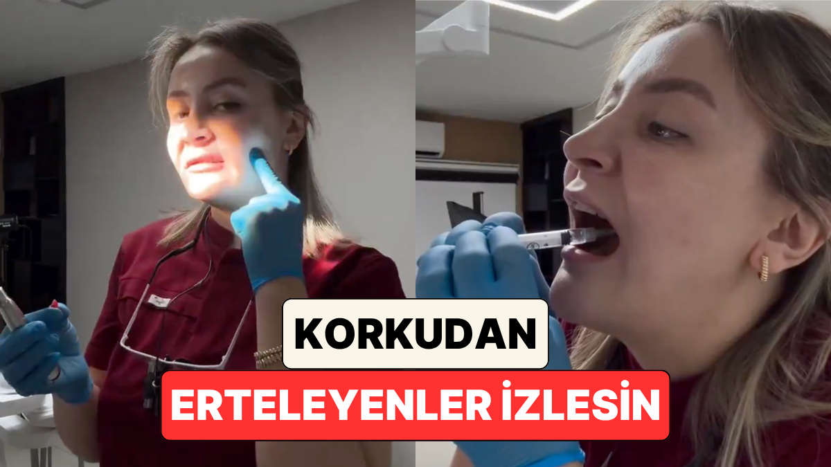 Terzi Kendi Döküğünü Dikebiliyormuş: Bir Diş Hekimi Kendi 20 Yaş Dişini Çekti