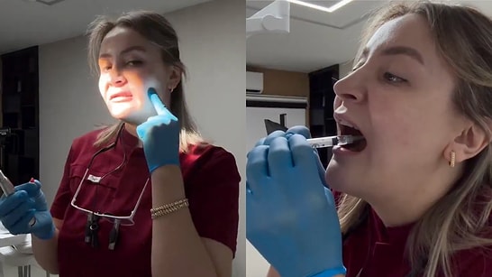 A Skilled Dentist Successfully Performs Their Own Wisdom Tooth Extraction With Precision