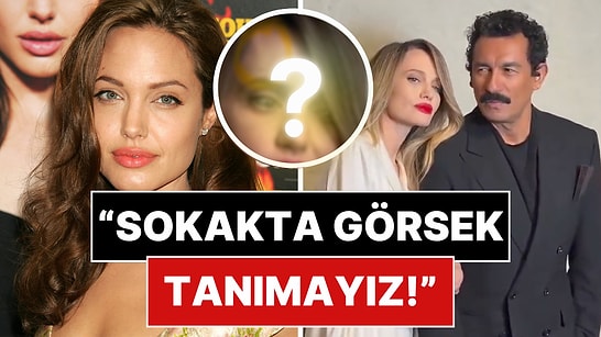 Angelina Jolie’nin Son Hali Gündem Oldu: Yüzündeki O Detay Dikkat Çekti!