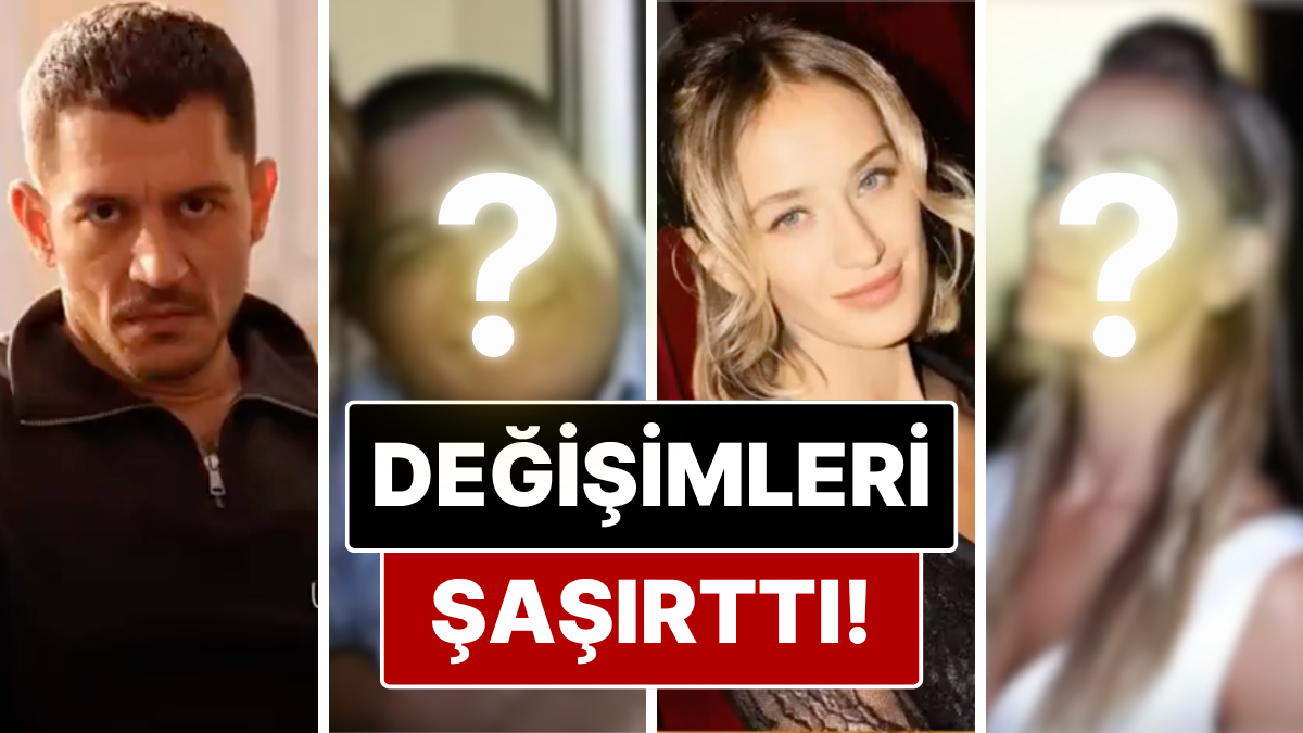 Ünlülerin Değişimi Dikkat Çekti: Eski ve Yeni Halleri Karşılaştırıldı!