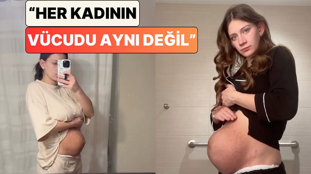 Doğum Yapan Bir Kadın Karnında Günden Güne Meydana Gelen Değişimi Paylaştı
