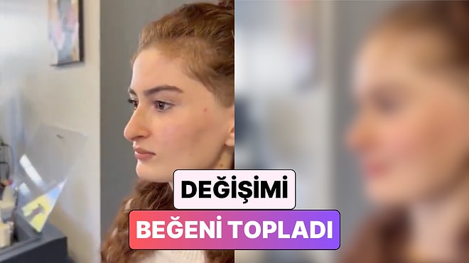 Yerinde Bir Dokunuş: Burun Estetiği Yaptıran Bir Kadının Değişimi Beğeni Topladı