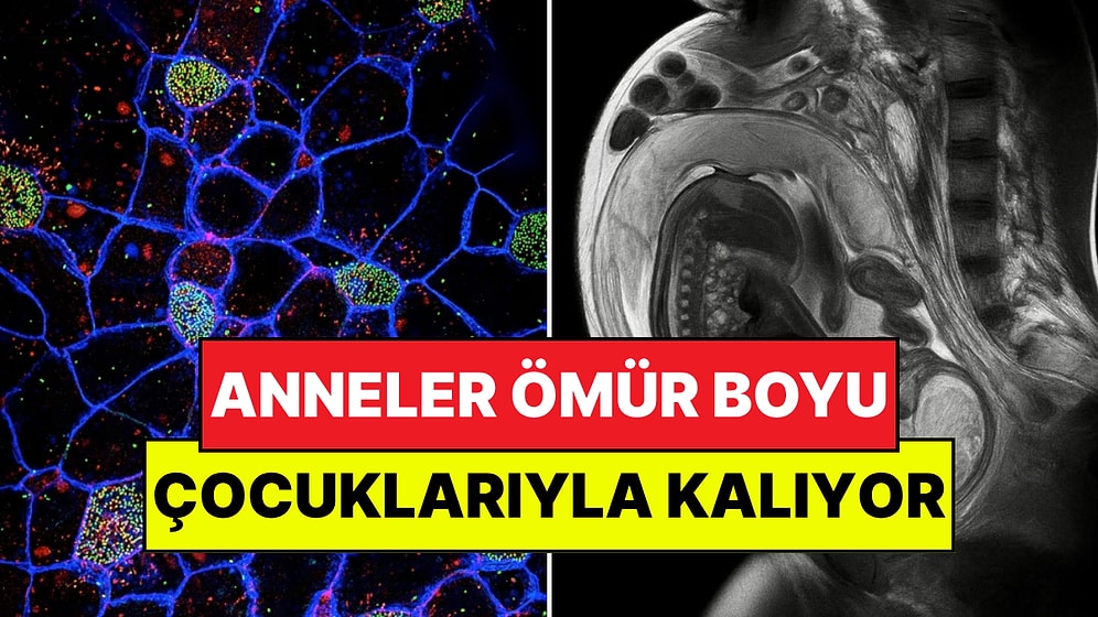 Bilim Kanıtladı: Annelerin Hücreleri Çocuklarının Vücudunda Ömür Boyu Kalıyor