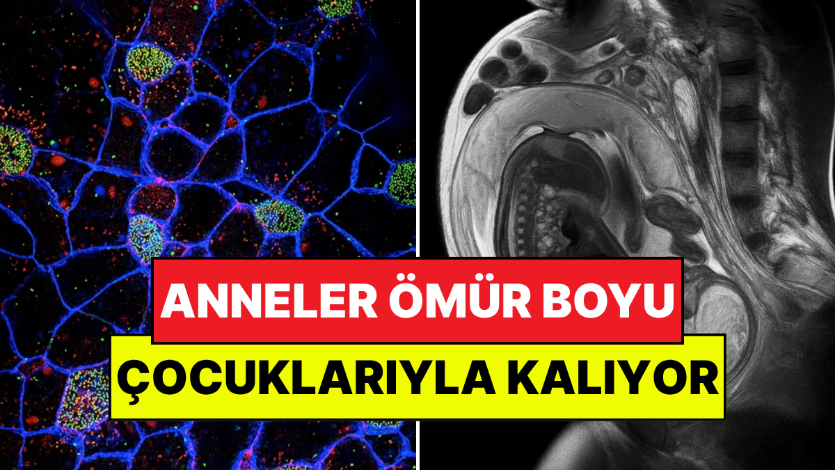 Bilim Kanıtladı: Annelerin Hücreleri Çocuklarının Vücudunda Ömür Boyu Kalıyor