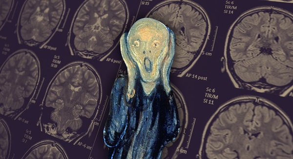 Araştırma, travma ve kaygı bozuklukları için yeni tedavi ihtimalini gündeme getirdi